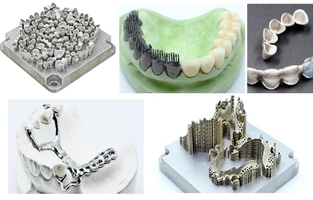 3d printing in the dental industry